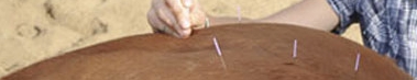 How and Why Does Acupuncture Work?